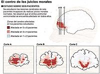Daño cerebral sobrevenido, ciencia, emociones y valores morales